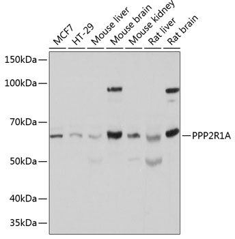 Anti-PPP2R1A Antibody (CAB5799)