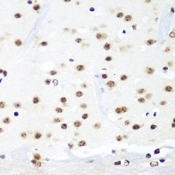 Anti-HTATSF1 Antibody (CAB5977)