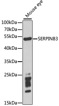 Anti-SERPINB3 Antibody (CAB5418)