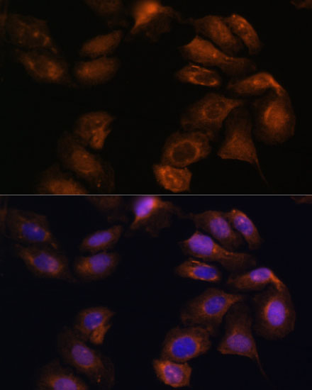 Anti-ROBO1 Antibody (CAB15313)