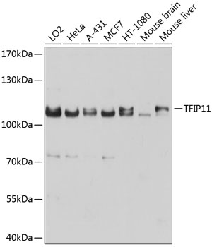 Anti-TFIP11 Polyclonal Antibody (CAB9000)