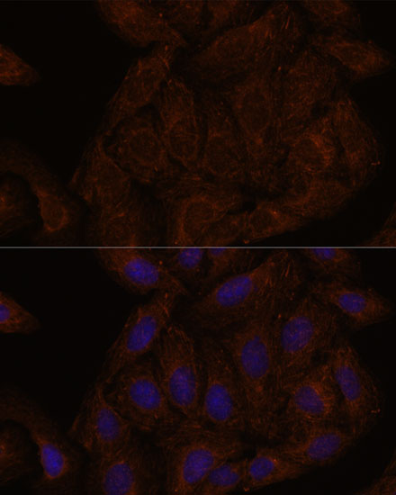 Anti-SEPT8 Antibody (CAB15011)