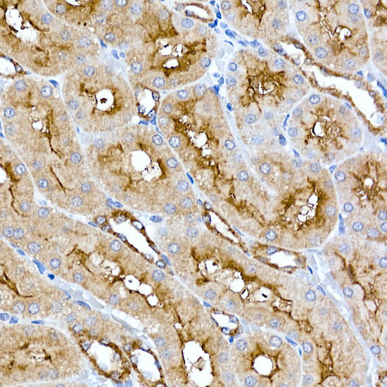 Immunohistochemistry of paraffin-embedded rat kidney using Folate Binding Protein(FBP) / FOLR1 Rabbit mAb at dilution of 1:100 (40x lens). Perform microwave antigen retrieval with 10 mM PBS buffer pH 7. 2 before commencing with IHC staining protocol.