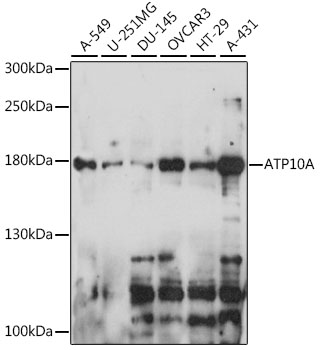 Anti-ATP10A Antibody (CAB15873)