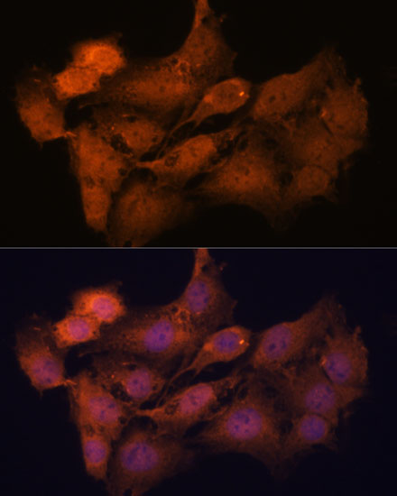 Anti-SYCP2 Antibody (CAB16098)