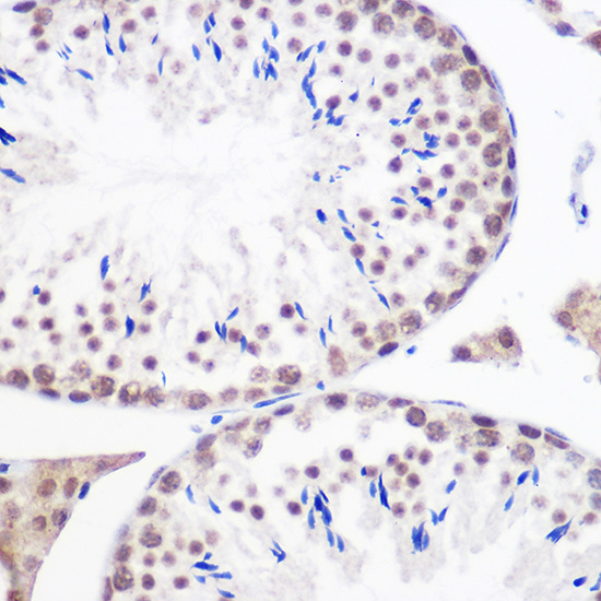 Anti-GMNN Antibody (CAB5316)