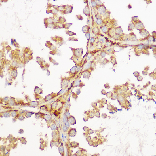 Anti-GFRA1 Antibody (CAB5373)