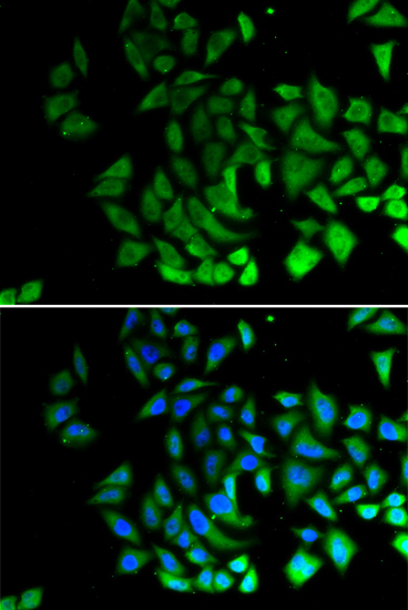 Anti-PIWIL-1 Antibody (CAB12349)