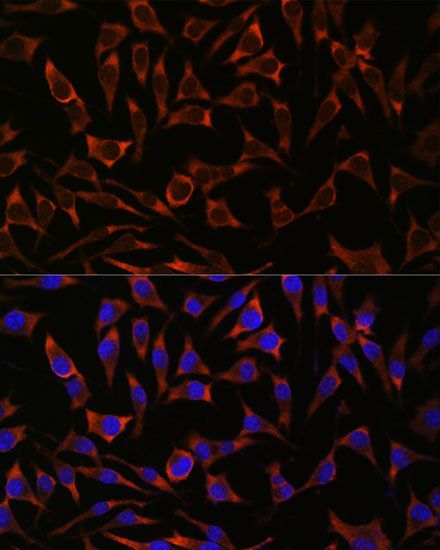 Anti-SEPT8 Antibody (CAB15011)