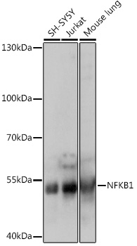 Anti-NFKB1 Antibody (CAB14754)