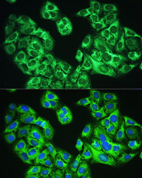 Anti-YTHDF1 Antibody (CAB13260)