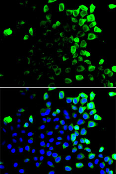 Anti-SLAMF7 Antibody (CAB14144)