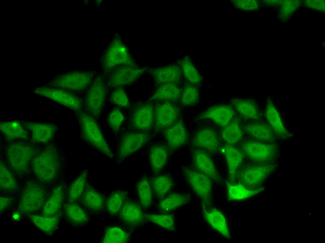 Anti-IRF8 Antibody (CAB13677)