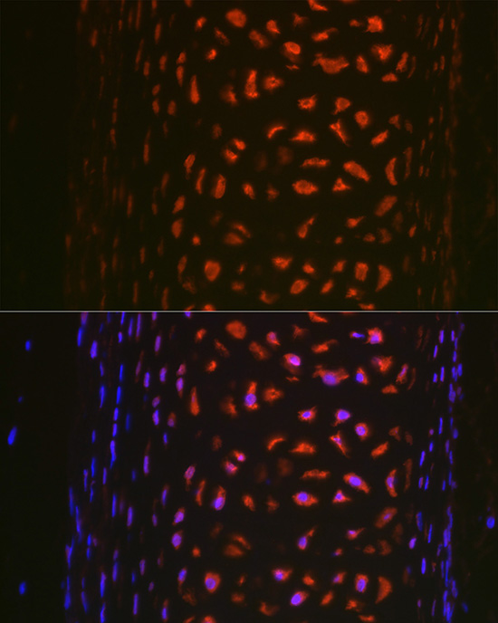 Anti-MMP13 Antibody [KO Validated] (CAB16920)