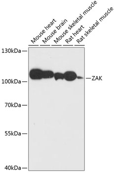 Anti-ZAK Antibody (CAB14513)