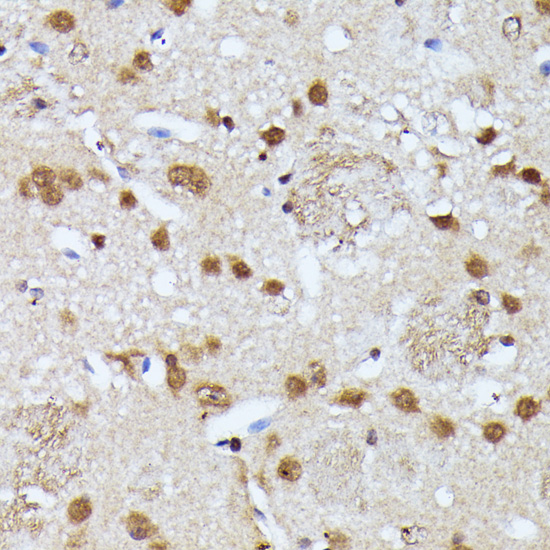 Anti-KIAA1429 Antibody (CAB16201)