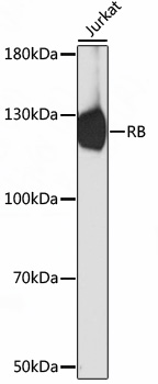 Anti-RB Antibody (CAB17005)