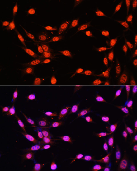 Anti-KLF2 Antibody (CAB16480)