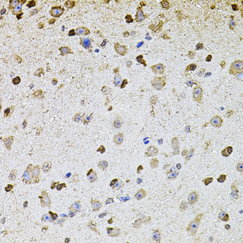 Anti-ALDH1A1 Antibody (CAB1802)