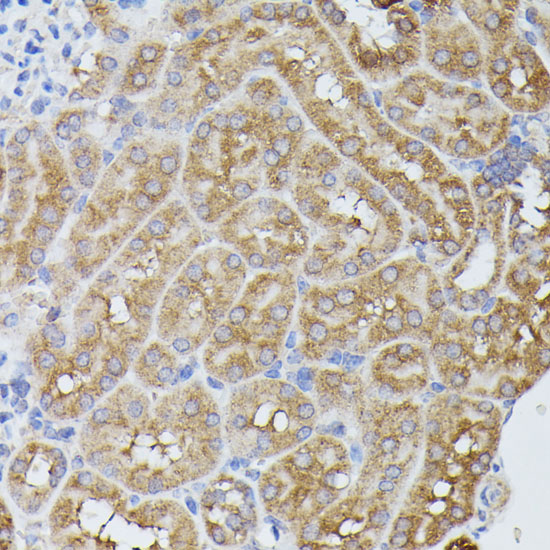 Anti-PPP2R5D Antibody (CAB15707)