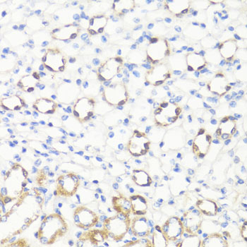 Anti-SS18L1 Polyclonal Antibody (CAB8822)