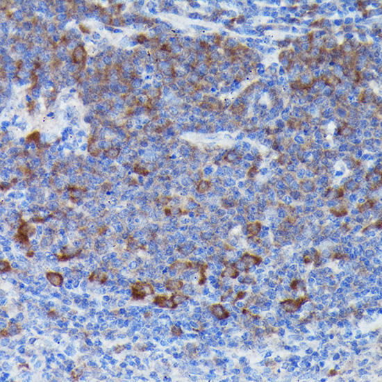 Anti-SOCS3 Antibody (CAB0694)