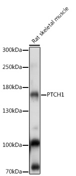 Anti-PTCH1 Antibody (CAB14772)