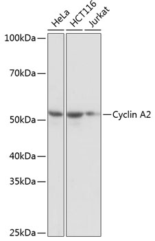 Anti-Cyclin A2 Antibody (CAB19036)