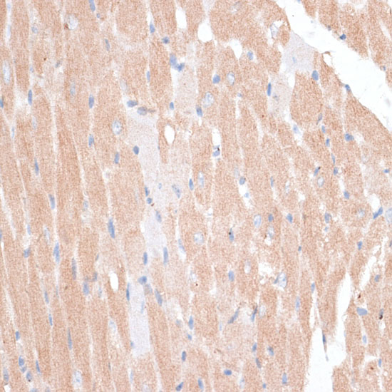 Anti-KATNA1 Antibody (CAB16491)