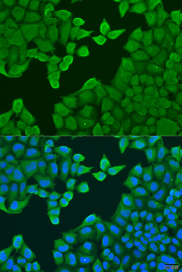 Anti-ARF3 Polyclonal Antibody (CAB8101)