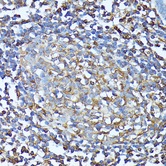 Anti-CXCR1 Antibody (CAB16386)