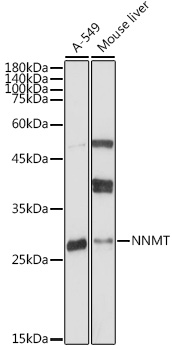 Anti-NNMT Antibody [KO Validated] (CAB18033)