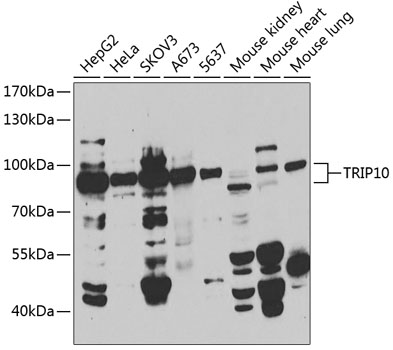 Anti-TRIP10 Antibody (CAB7038)