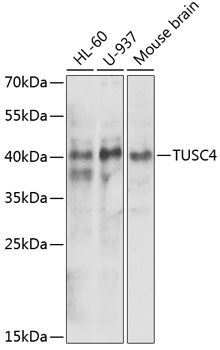 Anti-NPRL2 Antibody (CAB5859)