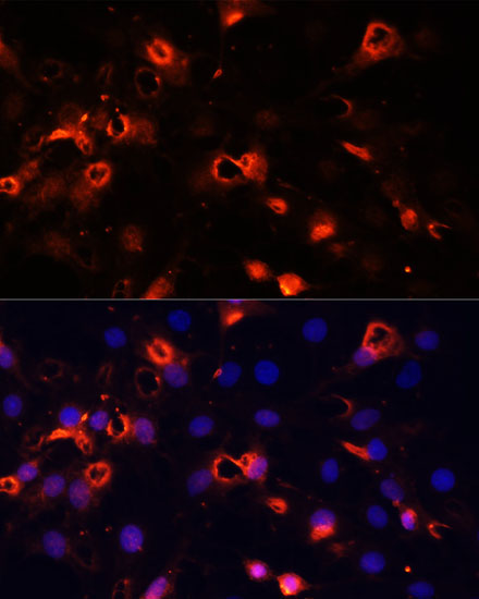 Anti-SMO Antibody (CAB3274)