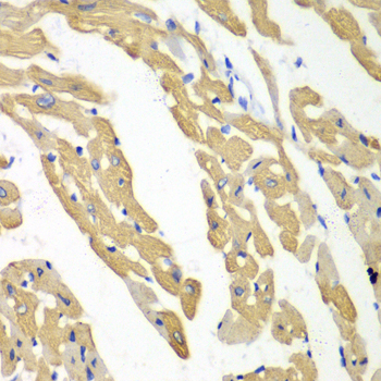 Anti-DKK3 Antibody (CAB2527)