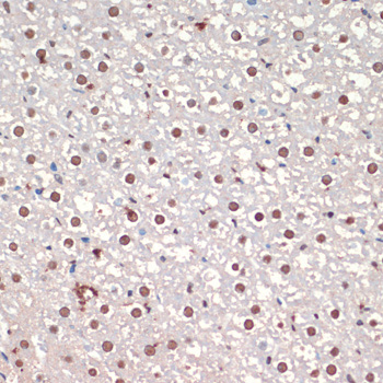 Anti-TARDBP Antibody (CAB17114)