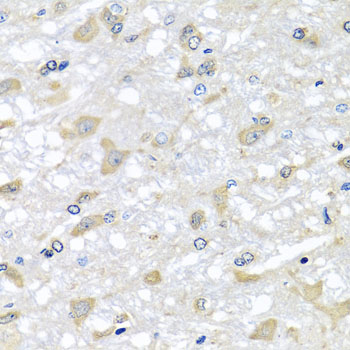 Anti-RPLP1 Antibody (CAB6725)