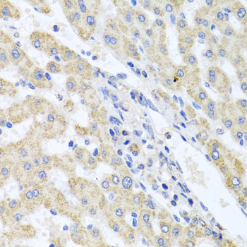 Anti-ITPKB Antibody (CAB3929)