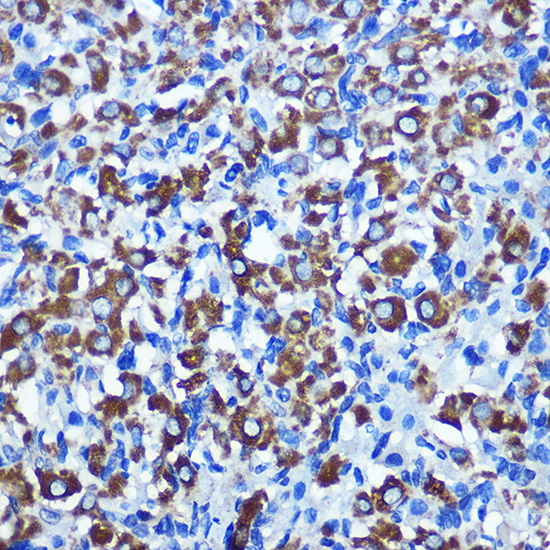 Anti-NEK2 Antibody (CAB13334)