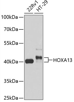 Anti-HOXA13 Antibody (CAB13999)