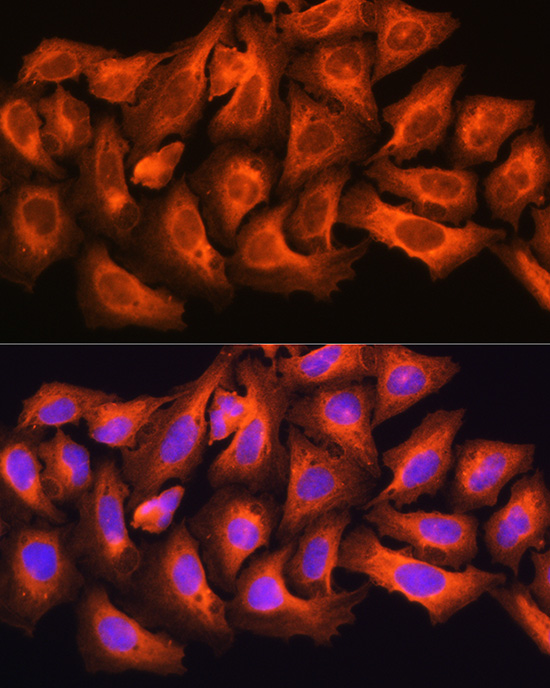 Anti-CKAP5 Polyclonal Antibody (CAB8532)