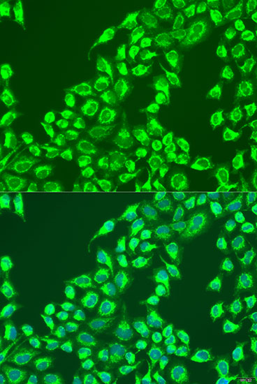 Anti-BAIAP2L1 Antibody (CAB15173)