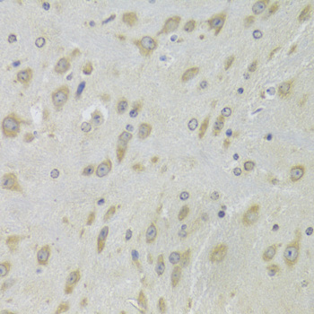 Anti-DHRS9 Antibody (CAB6324)