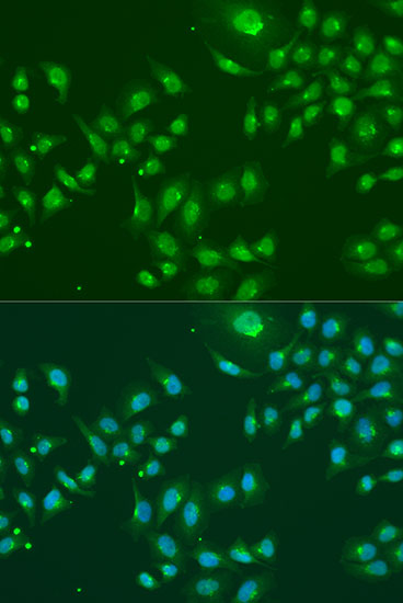 Anti-IFIT3 Antibody (CAB3924)