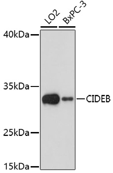 Anti-CIDEB Antibody (CAB17140)