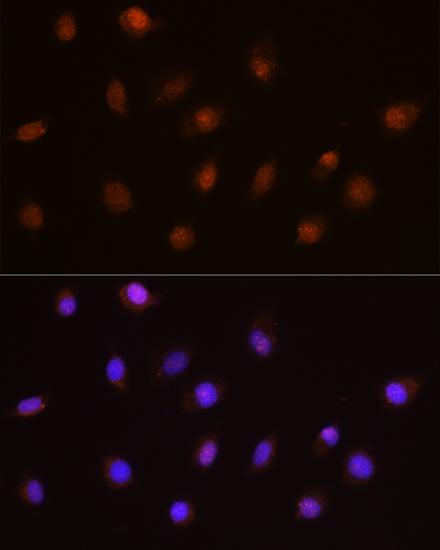 Anti-USP4 Antibody (CAB12242)