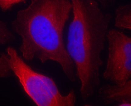 Anti-Phospho-TH-S19 Antibody (CABP0461)