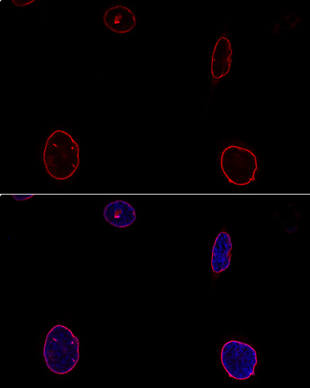 Anti-EMD Antibody (CAB13925)