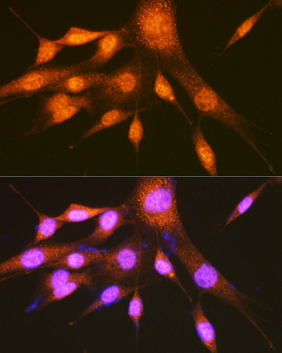 Anti-PCBP2 Antibody (CAB2531)